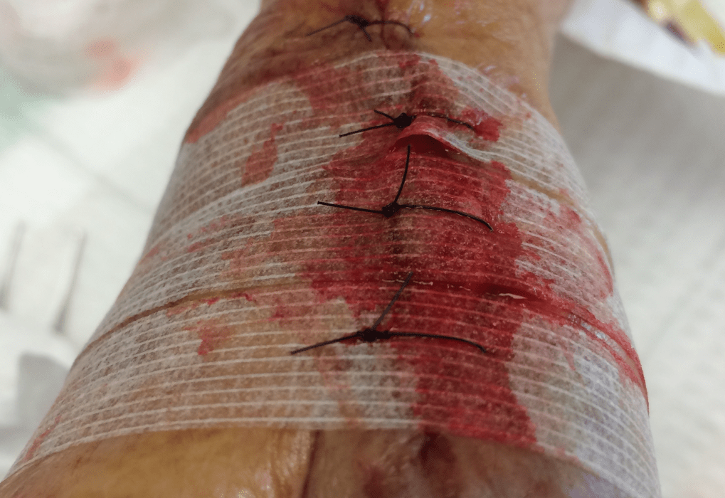 Skärmavbild 2018-03-08 kl. 11.24.58.png