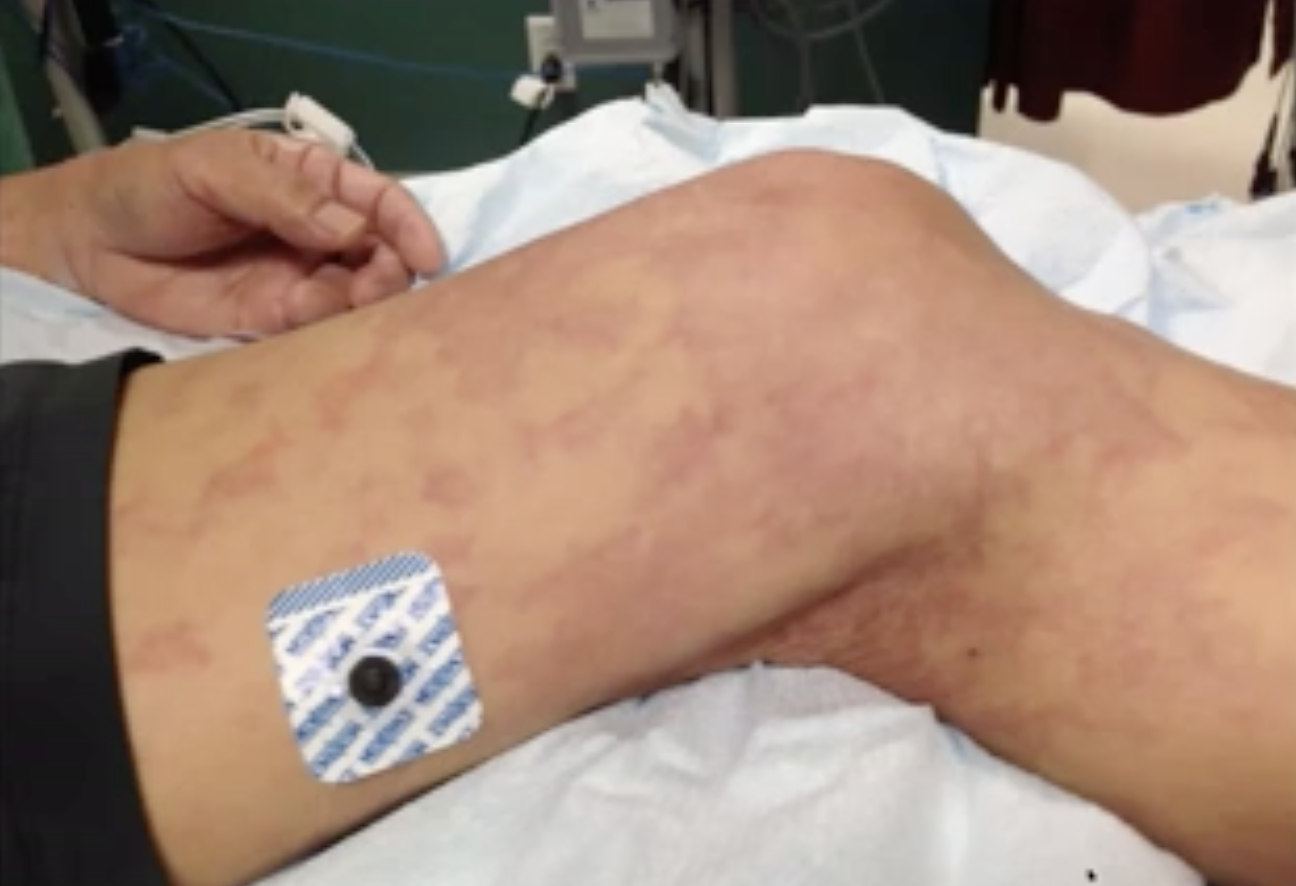 Skärmavbild 2020-04-25 kl. 21.49.56.png