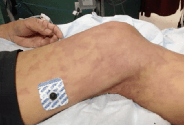 Skärmavbild 2020-04-25 kl. 21.49.56.png