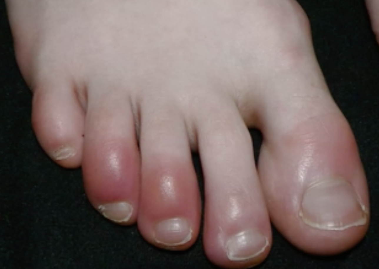 Skärmavbild 2020-04-25 kl. 22.02.14.png